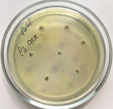 Нижегородка подхватила жуткую инфекцию из-за маникюра - фото 1